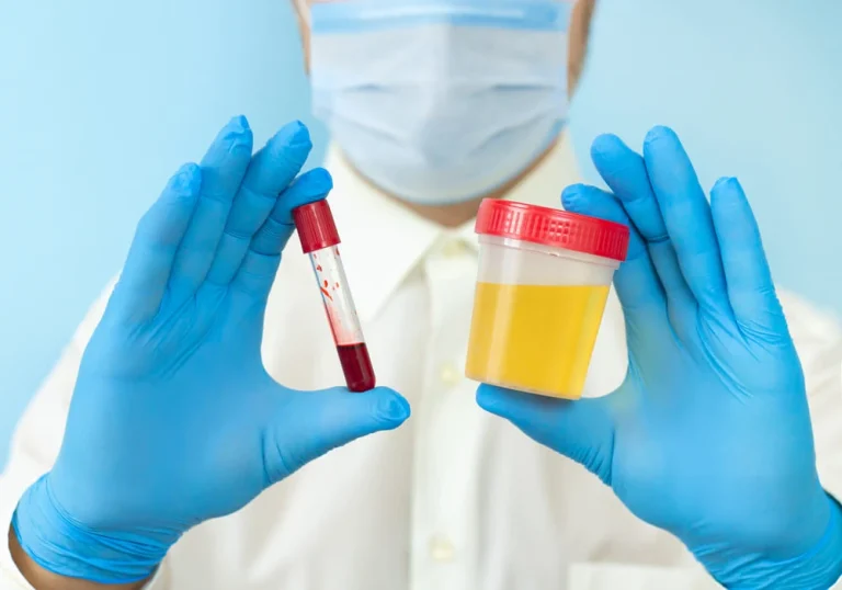 Proteine în Urină: Cauze, Diagnostic și Management
