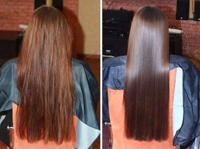Cum sa scapi de matreata cu otet: Solutia naturala pentru un scalp curat